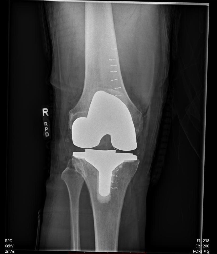 X-ray by Sutter Davis Hospital